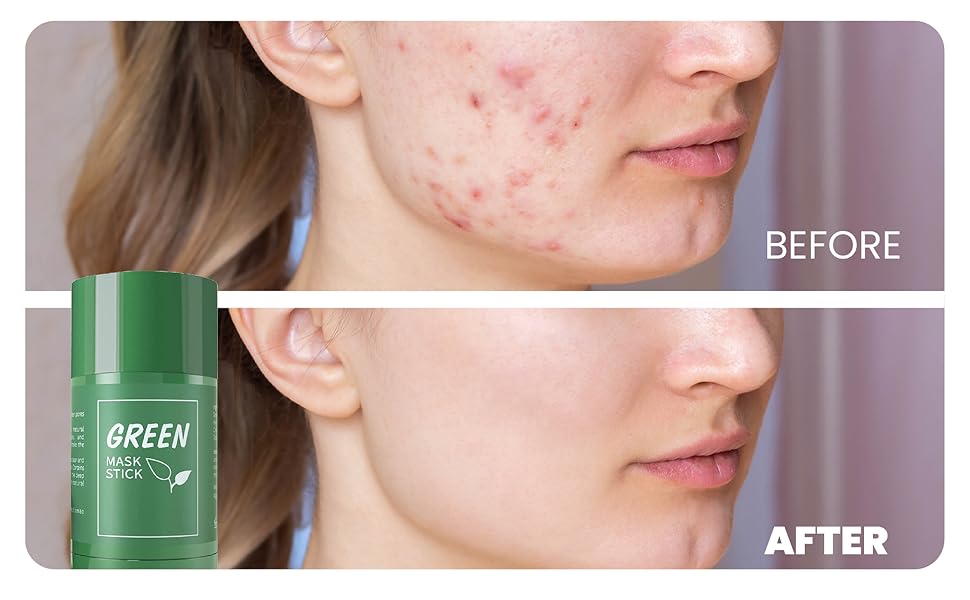 Green Tea Herbal Mask Stick Cream for Removes Blackheads