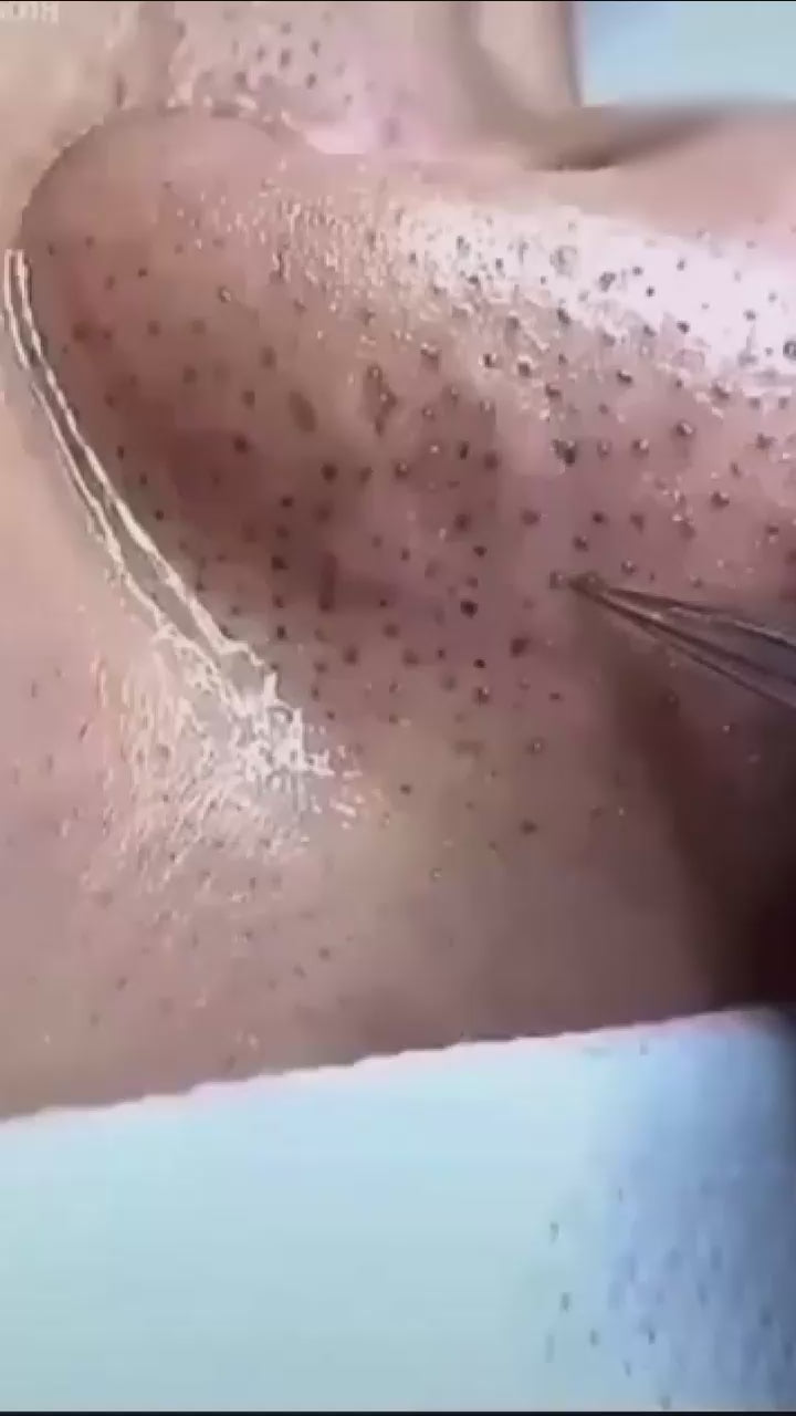 Green Tea Herbal Mask Stick Cream for Removes Blackheads